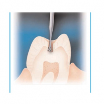 Standard Straight HP